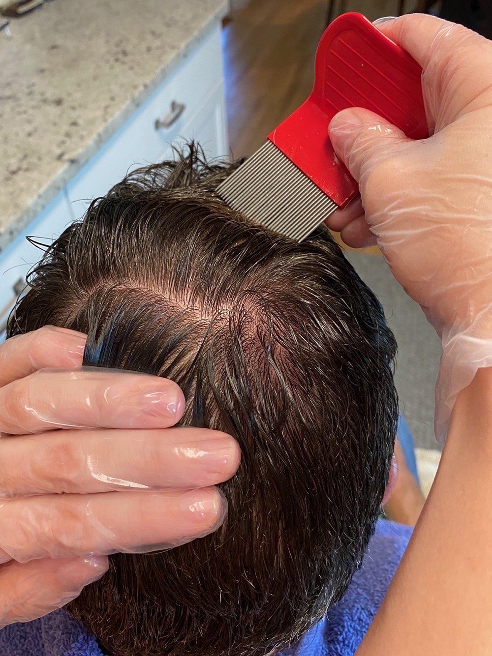 Head Lice Treatment Removal Service in Avondale, Arizona LiceDoctors